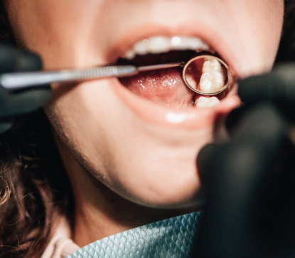 clinicas dentales Inmunodent clínicas dentales